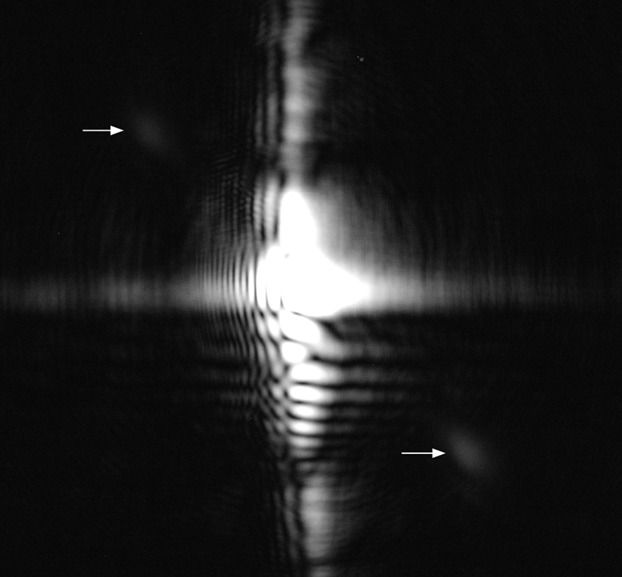 Brillouin Spectroscopy Laser Application