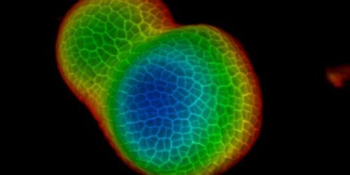 Confocal Microscopy Laser Application