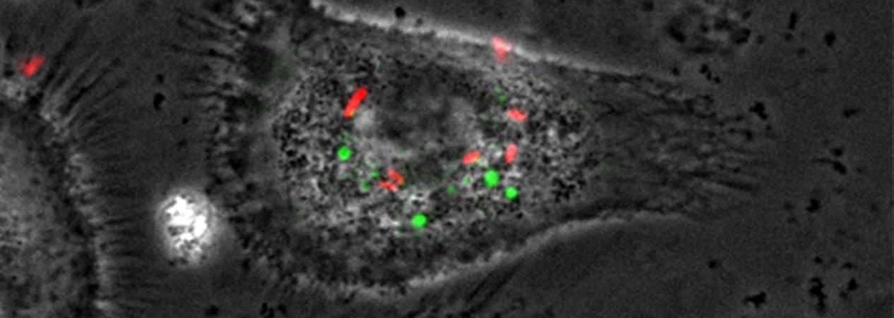 Spinning-disk confocal microscopy image of HIV-infected macrophages with Salmonella in BSL-3 — Institut Cochin IMAG'IClaser combiner