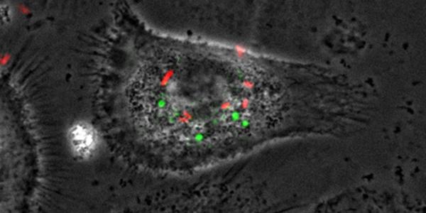Spinning-disk confocal microscopy image of HIV-infected macrophages with Salmonella in BSL-3 — Institut Cochin IMAG'IClaser combiner