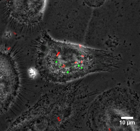 spinning-disk confocal BSL-3