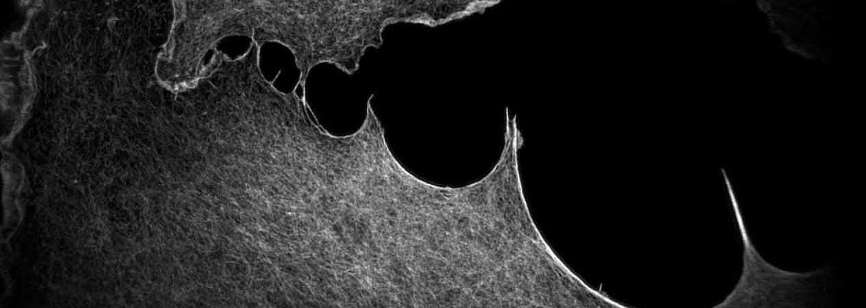 Super-resolution microscopy: Oxxius laser for LiveDRIMUse Case Rimeo