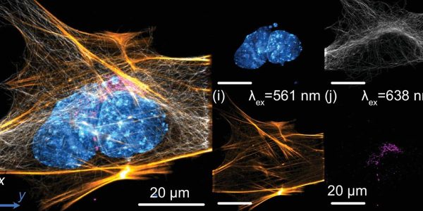 light-sheet fluorescence microscope