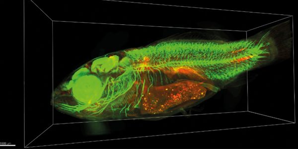 Mesospim laser Oxxius Inrae